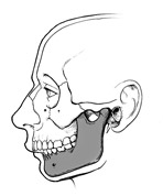 Orthognathic Surgery Illustration