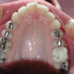 Orthodontic
