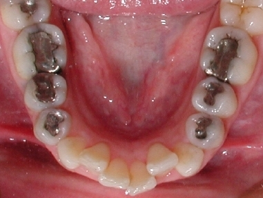 Orthodontic