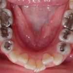 Orthodontic