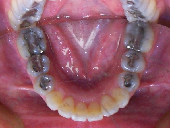 Orthodontic