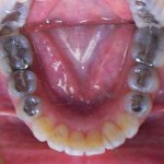 Orthodontic