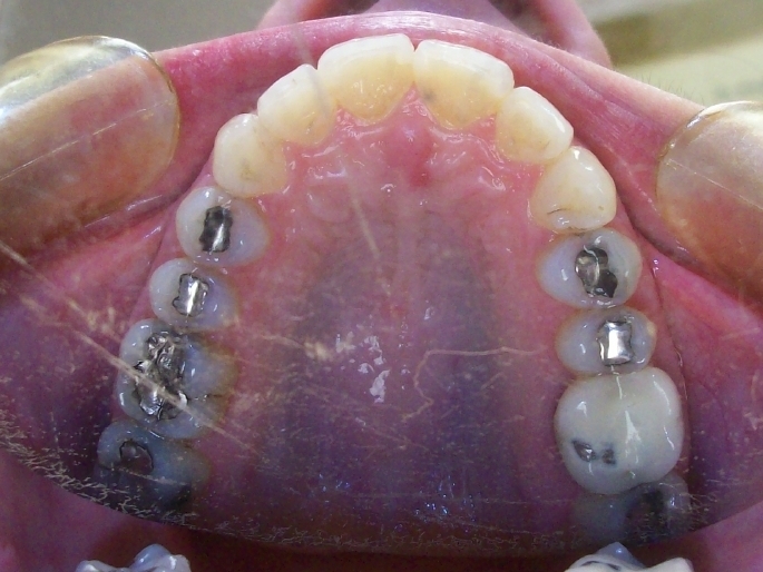 Orthodontic