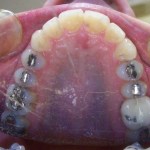 Orthodontic